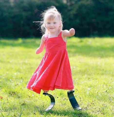 Five-Year Old Tests Hi-Tech Legs