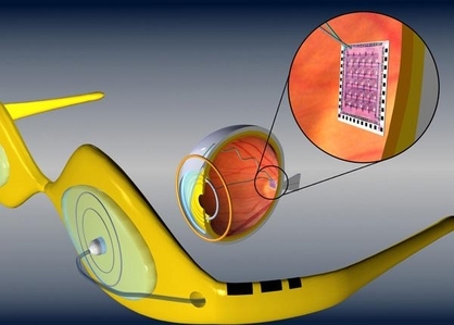 Bionic eye becomes a reality