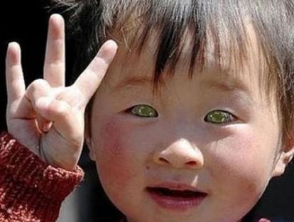 Chinese 'Cat-Boy' Has Built-In Night Vision